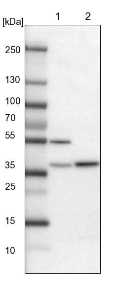 Lane 1: Mouse liver tissue lysateLane 2: Rat liver tissue lysate