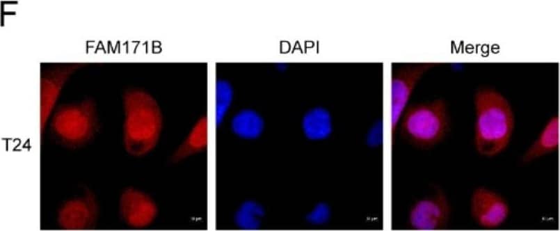 FAM171B interacts with vimentin and HNRNPU in bladder cancer cells. A Mass spectrometry analysis of interacting proteins enriched by immunoprecipitation. Immunoprecipitation is performed by Anti-DYKDDDDK beads on T24 cells transfected with FLAG-FAM171B or FLAG-control. B Analysis of positive and background proteins based on Mass Spectrometry scores. C The top 16 proteins with the highest scores based on MS results. D Protein interaction network map of proteins bound to FAM171B based on MS results. The protein interactions data is from STRING database. E The predicted protein structure image of FAM171B based on the Alpha Fold. F Immunofluorescence analysis images revealed the localization of FAM171B in T24 cells. G Colocalization of FAM171B and vimentin was visualized by confocal microscope in T24 cells. Cytoplasmic staining of FAM171B and vimentin was mostly merged together. H Colocalization of FAM171B and HNRNPU was visualized by confocal microscope in T24 cells. Nuclear staining of FAM171B and HNRNPU was mostly merged together. I ImageJ was used for colocation analysis of FAM171B and vimentin. Pearson correlation analysis showed that r > 0.5. Manders’ colocation coefficient showed that M1 > 0.5 and M2 > 0.5. J Computational docking model between FAM171B and vimentin. K ImageJ was used for colocation analysis of FAM171B and HNRNPU. Pearson correlation analysis showed that r > 0.5. Manders’ colocation coefficient showed that M1 > 0.5 and M2 > 0.5. L Computational docking model between FAM171B and HNRNPU Image collected and cropped by CiteAb from the following open publication (//pubmed.ncbi.nlm.nih.gov/37915048), licensed under a CC-BY license. Not internally tested by Novus Biologicals.