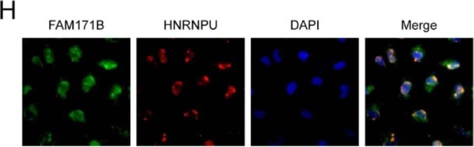 FAM171B interacts with vimentin and HNRNPU in bladder cancer cells. A Mass spectrometry analysis of interacting proteins enriched by immunoprecipitation. Immunoprecipitation is performed by Anti-DYKDDDDK beads on T24 cells transfected with FLAG-FAM171B or FLAG-control. B Analysis of positive and background proteins based on Mass Spectrometry scores. C The top 16 proteins with the highest scores based on MS results. D Protein interaction network map of proteins bound to FAM171B based on MS results. The protein interactions data is from STRING database. E The predicted protein structure image of FAM171B based on the Alpha Fold. F Immunofluorescence analysis images revealed the localization of FAM171B in T24 cells. G Colocalization of FAM171B and vimentin was visualized by confocal microscope in T24 cells. Cytoplasmic staining of FAM171B and vimentin was mostly merged together. H Colocalization of FAM171B and HNRNPU was visualized by confocal microscope in T24 cells. Nuclear staining of FAM171B and HNRNPU was mostly merged together. I ImageJ was used for colocation analysis of FAM171B and vimentin. Pearson correlation analysis showed that r > 0.5. Manders’ colocation coefficient showed that M1 > 0.5 and M2 > 0.5. J Computational docking model between FAM171B and vimentin. K ImageJ was used for colocation analysis of FAM171B and HNRNPU. Pearson correlation analysis showed that r > 0.5. Manders’ colocation coefficient showed that M1 > 0.5 and M2 > 0.5. L Computational docking model between FAM171B and HNRNPU Image collected and cropped by CiteAb from the following open publication (//pubmed.ncbi.nlm.nih.gov/37915048), licensed under a CC-BY license. Not internally tested by Novus Biologicals.