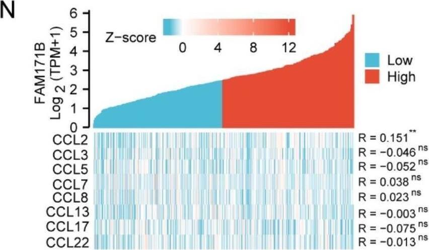 FAM171B expression is positively correlated with tumor progression and M2 TAM infiltration in BLCA patients. A Analysis of FAM171B expression in tumor tissue and paired normal tissue from TCGA dataset. B Representative IHC staining images of FAM171B in BLCA tissue array. C IHC score in different T stages from BLCA tissue array. D IHC score in different N stages from BLCA tissue array. E Relationship between FAM171B expression level and overall survival from TCGA dataset. F Relationship between FAM171B expression level and progression free survival from TCGA dataset. G Relationship between FAM171B expression level and disease specific survival from TCGA dataset. H Relationship between FAM171B expression level and disease-free survival from TCGA dataset. I Relationship between FAM171B expression level and overall survival from GEO dataset (GSE13507/GSE31684/GSE32894/GSE37815). J Analysis of FAM171B expression in different T stages from TCGA dataset. K Analysis of FAM171B expression in different N stages from TCGA dataset. L Analysis of FAM171B expression in different pathologic stages from TCGA dataset. M Lollipop plot demonstrating the correlation between FAM171B expression and different immune cell infiltration. N Heat map of the correlation between FAM171B expression and major monocyte/macrophage chemokines. O Immunoscore analysis of FAM171B and M1 macrophages in bladder cancer using QUANTISEQ algorithm. P Immunoscore analysis of FAM171B and M2 macrophages in bladder cancer using QUANTISEQ algorithm. Q Representative IHC staining images (FAM171B) and IF staining images (CD206, CD8 and  alpha -SMA) in BLCA tissue array. R Proportion of immunofluorescence-positive cells (CD206, CD8 and  alpha -SMA) in FAM171B high or low expression group from tissue array Image collected and cropped by CiteAb from the following open publication (//pubmed.ncbi.nlm.nih.gov/37915048), licensed under a CC-BY license. Not internally tested by Novus Biologicals.