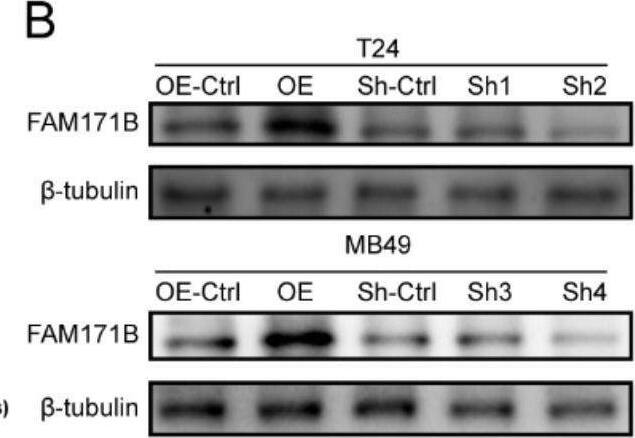 FAM171B promotes the malignant phenotype of bladder cancer cells. A The Chronos dependency score analysis of FAM171B in the 28 human bladder urothelial carcinoma cell lines in the CCLE database. The Chronos dependency score is based on data from a cell depletion assay. A lower Chronos score indicates a higher likelihood that the gene of interest is essential in a given cell line. B Protein levels of FAM171B in the knockdown and overexpression cell lines. C Representative colony formation images in different groups. D Colony formation analysis of T24 and MB49 cells after knockdown and overexpression of FAM171B. E Cell viability of T24 and MB49 after knockdown and overexpression of FAM171B. F Representative transwell images of T24 and MB49 cells after knockdown and overexpression of FAM171B. G Statistical results of the number of invasive cells in each group of T24 and MB49 cells. H Representative images of migration in T24 and MB49 cells after knockdown and overexpression of FAM171B. I Statistical results of the number of migrated cells in each group of T24 and MB49 cells Image collected and cropped by CiteAb from the following open publication (//pubmed.ncbi.nlm.nih.gov/37915048), licensed under a CC-BY license. Not internally tested by Novus Biologicals.
