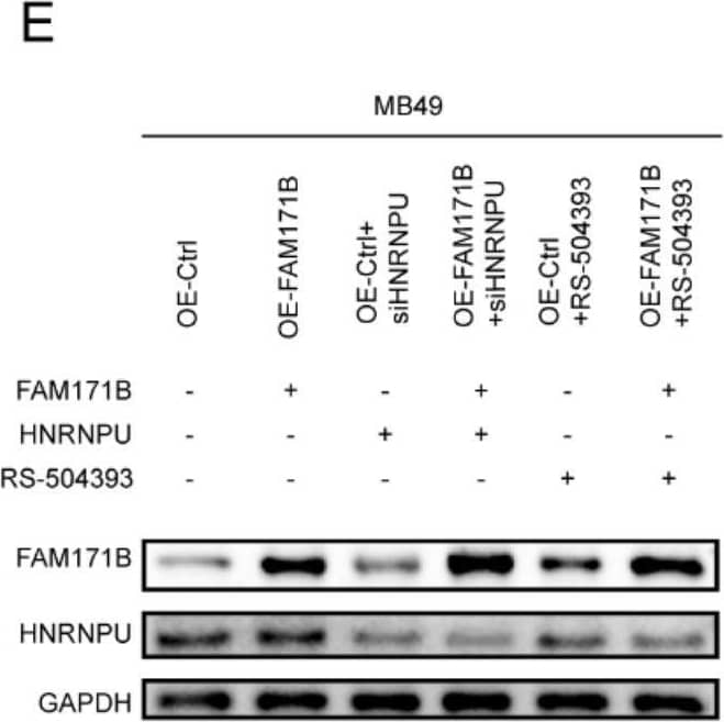 FAM171B regulates CCL2 via HNRNPU and promotes TAM migration and infiltration in bladder cancer. A ELISA analysis of CCL2 secretion levels in MB49 cells with FAM171B overexpression or knockdown. B RIP results show that HNRNPU can immunoprecipitate with CCL2 precursor RNA. C qRT-PCR analysis of the relative RNA levels of precursor CCL2 and CCL2 in MB49 cells with HNRNPU knockdown or control. D ELISA analysis of CCL2 secretion levels in MB49 cells with HNRNPU knockdown or control. E Protein levels of FAM171B and HNRNPU in the MB49 cell lines in different groups. F ELISA analysis of CCL2 secretion levels in MB49 cells in different groups. G Analysis of migration of RAW264.7(mouse macrophages) toward MB49 cells in different groups. H Representative images of migration of RAW264.7(mouse macrophages) toward MB49 cells in co-culture chambers. I The pictures of tumors derived from mouse bladder cancer MB49 cell line. J IHC staining pictures of F4/80(macrophage marker) expression in different groups. K Representative images of flow cytometry used to evaluate F4/80 positive subpopulations. L The tumor weight in different groups. M The tumor volume in different groups. N The average body weight of mice in different groups. O Analysis of F4/80 positive population by IHC. P Analysis of F4/80 positive population by flow cytometry Image collected and cropped by CiteAb from the following open publication (//pubmed.ncbi.nlm.nih.gov/37915048), licensed under a CC-BY license. Not internally tested by Novus Biologicals.