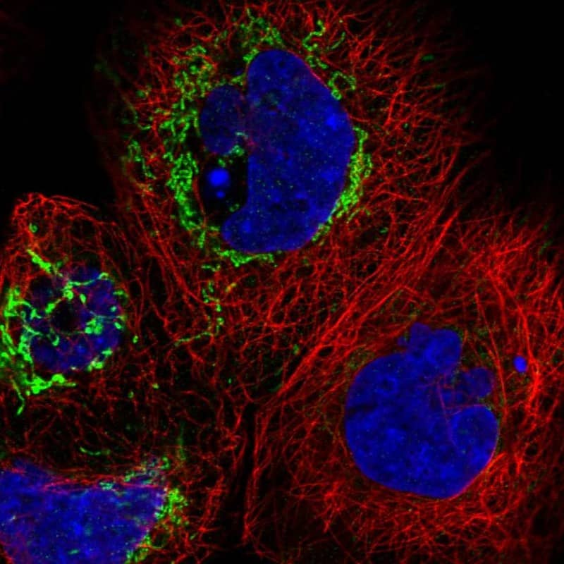 Immunocytochemistry/ Immunofluorescence THAP9 Antibody - BSA Free