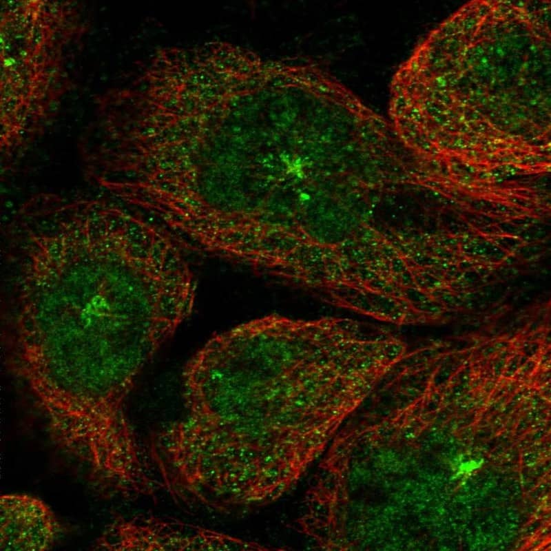 Staining of human cell line A-431 shows localization to nucleoplasm, cytosol & microtubule organizing center.