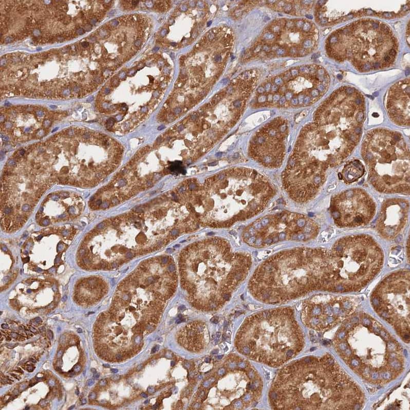Staining of human kidney shows moderate granular cytoplasmic positivity in cells in tubules.