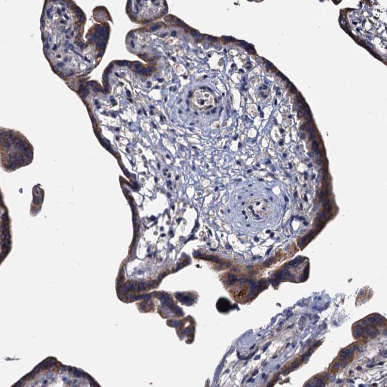 Immunohistochemistry-Paraffin ARHGAP42 Antibody - BSA Free