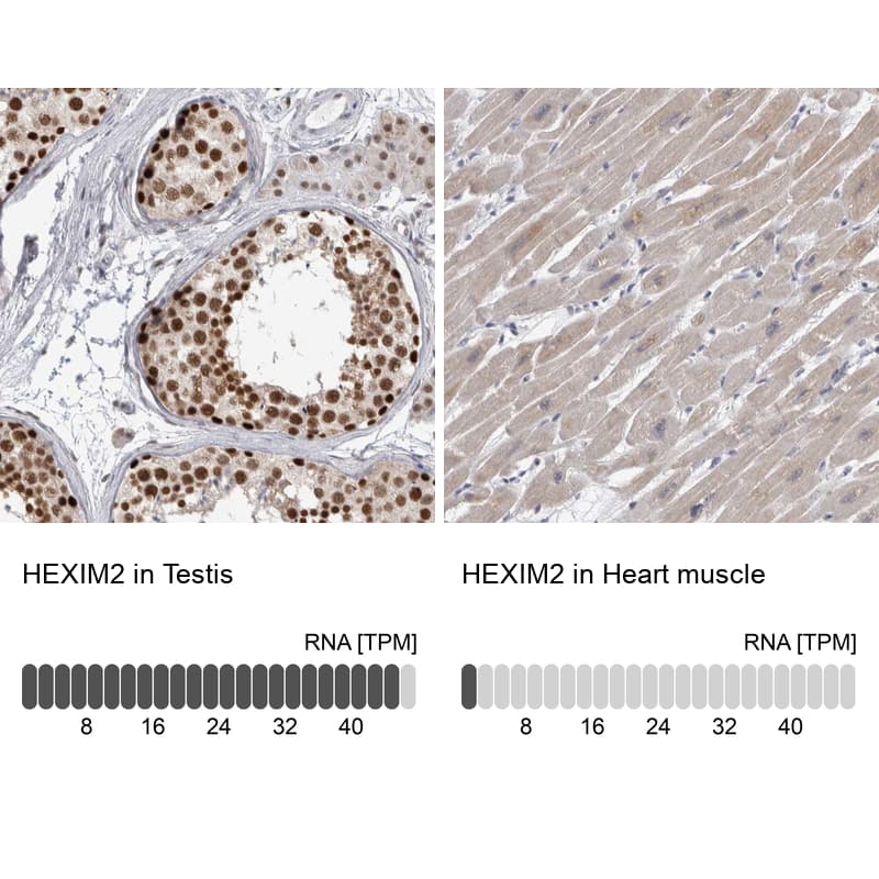 <b>Orthogonal Strategies Validation. </b>Analysis in human testis and heart muscle tissues using Anti-HEXIM2 antibody. Corresponding HEXIM2 RNA-seq data are presented for the same tissues.