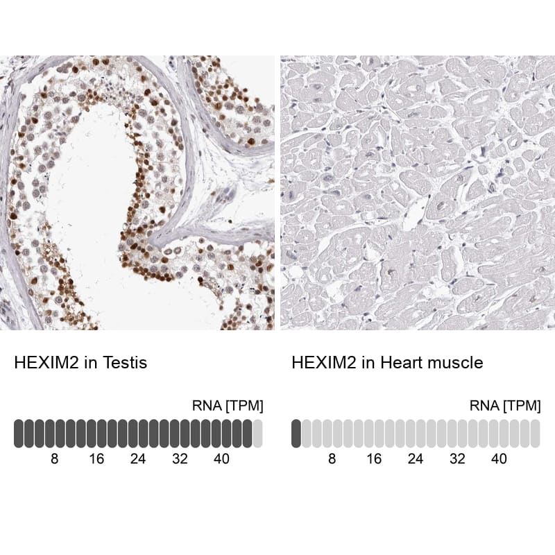 Analysis in human testis and heart muscle tissues using Anti-HEXIM2 antibody. Corresponding HEXIM2 RNA-seq data are presented for the same tissues.