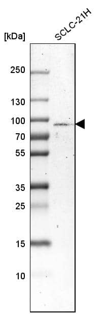Analysis in human cell line SCLC-21H.