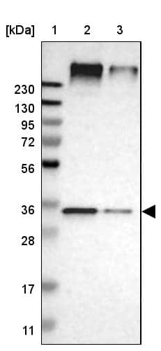 Lane 1: Marker [kDa] 230, 130, 95, 72, 56, 36, 28, 17, 11Lane 2: Human cell line RT-4Lane 3: Human cell line U-251MG sp