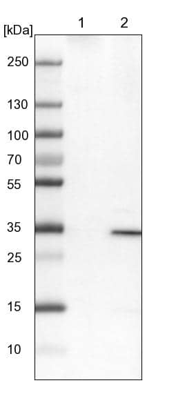 Lane 1: NIH-3T3 cell lysate (Mouse embryonic fibroblast cells)Lane 2: NBT-II cell lysate (Rat Wistar bladder tumour cells)