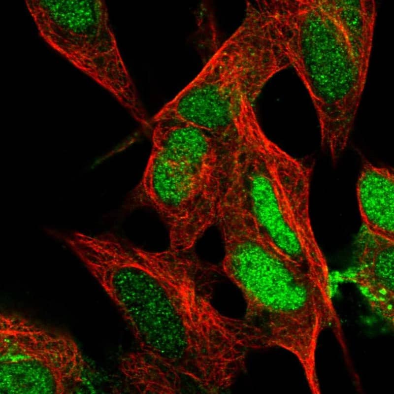 Staining of human cell line SH-SY5Y shows localization to nucleus & plasma membrane.