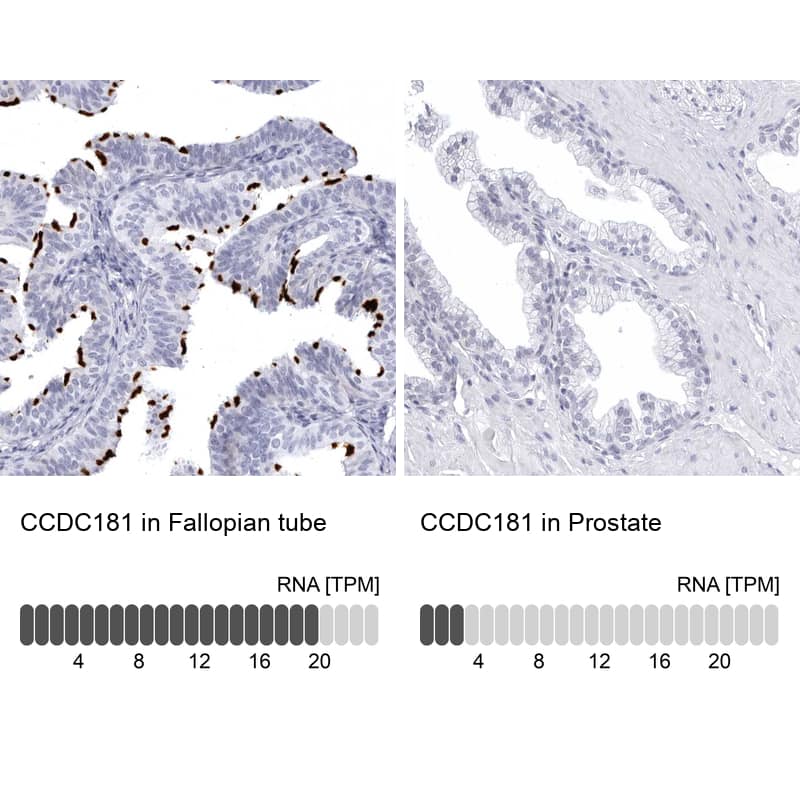 <b>Orthogonal Strategies Validation. </b>Analysis in human fallopian tube and prostate tissues using NBP1-93898 antibody. Corresponding CCDC181 RNA-seq data are presented for the same tissues.