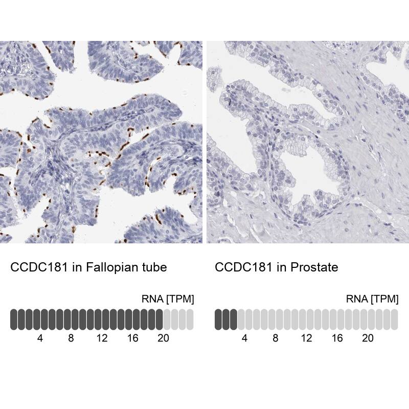 <b>Orthogonal Strategies Validation. </b>Analysis in human fallopian tube and prostate tissues using NBP1-93899 antibody. Corresponding CCDC181 RNA-seq data are presented for the same tissues.