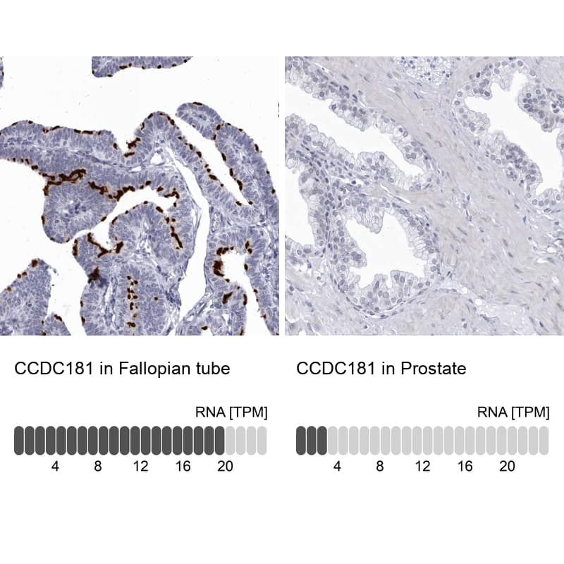 <b>Orthogonal Strategies Validation. </b>Analysis in human fallopian tube and prostate tissues using NBP1-93900 antibody. Corresponding CCDC181 RNA-seq data are presented for the same tissues.