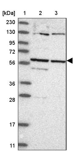 Lane 1: Marker [kDa] 230, 130, 95, 72, 56, 36, 28, 17, 11Lane 2: Human cell line RT-4Lane 3: Human cell line U-251MG sp