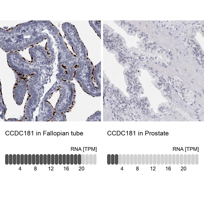 Analysis in human fallopian tube and prostate tissues using NBP1-93901 antibody. Corresponding CCDC181 RNA-seq data are presented for the same tissues.
