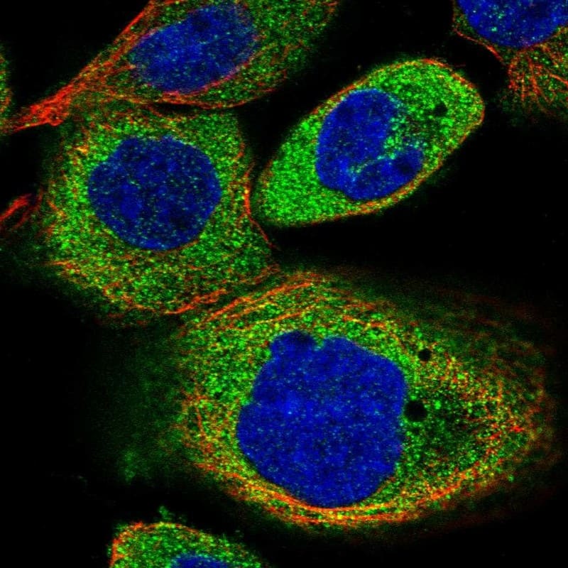 Staining of human cell line A-431 shows localization to cytosol.