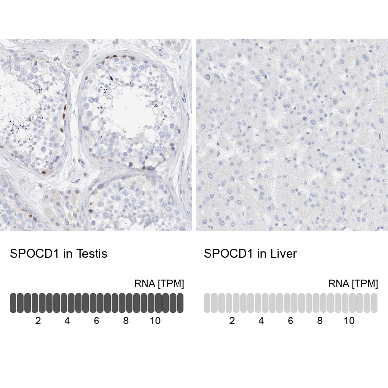 Immunohistochemistry SPOCD1 Antibody - BSA Free