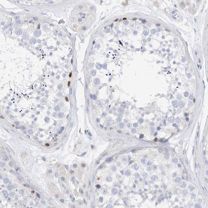 Immunohistochemistry SPOCD1 Antibody - BSA Free