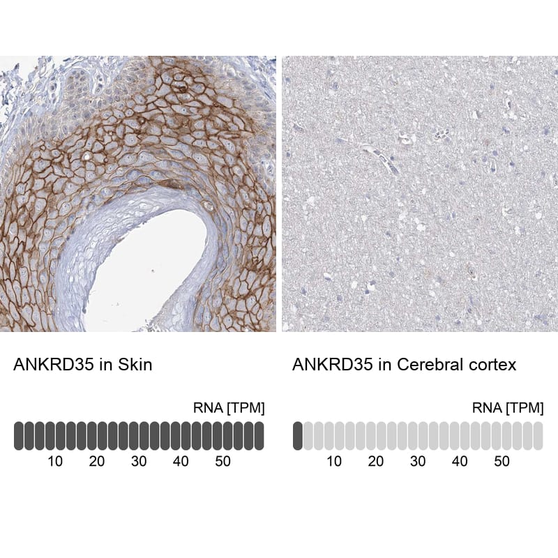 Immunohistochemistry ANKRD35 Antibody - BSA Free