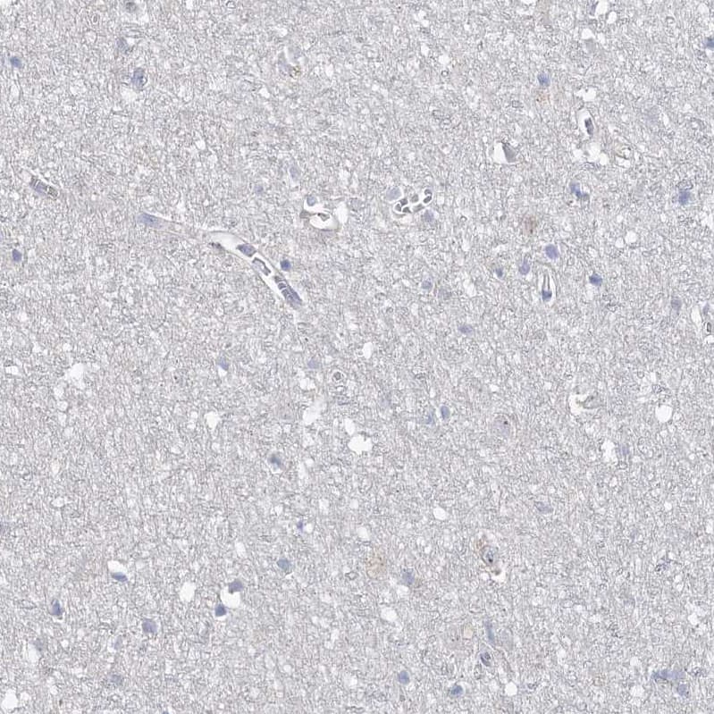 Immunohistochemistry ANKRD35 Antibody - BSA Free