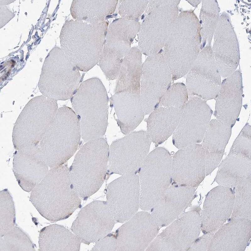 Immunohistochemistry ANKRD35 Antibody - BSA Free