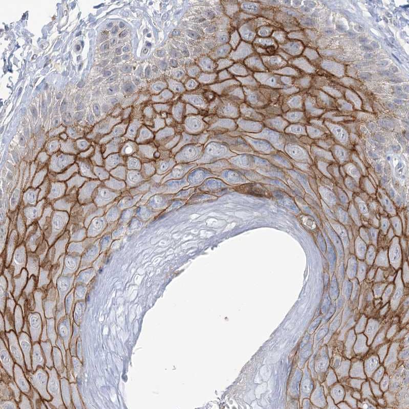Immunohistochemistry ANKRD35 Antibody - BSA Free