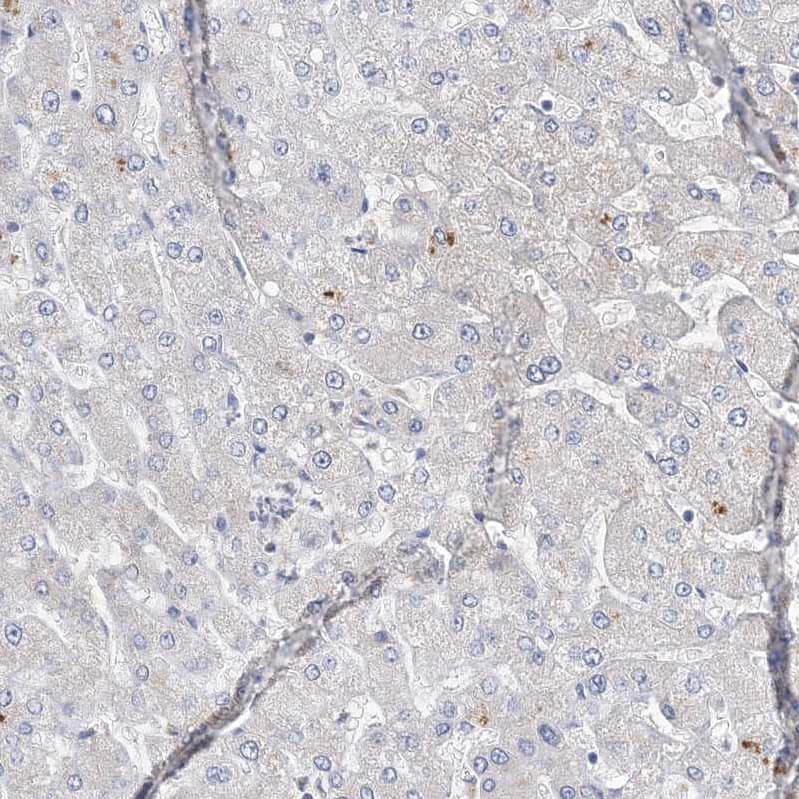 Immunohistochemistry ANKRD35 Antibody - BSA Free
