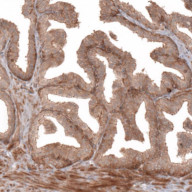 Staining of human prostate shows moderate membranous positivity in glandular cells.