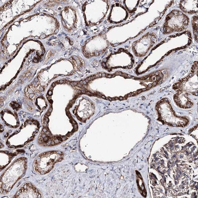 Staining of human kidney shows granular cytoplasmic positivity in glomeruli and tubules.