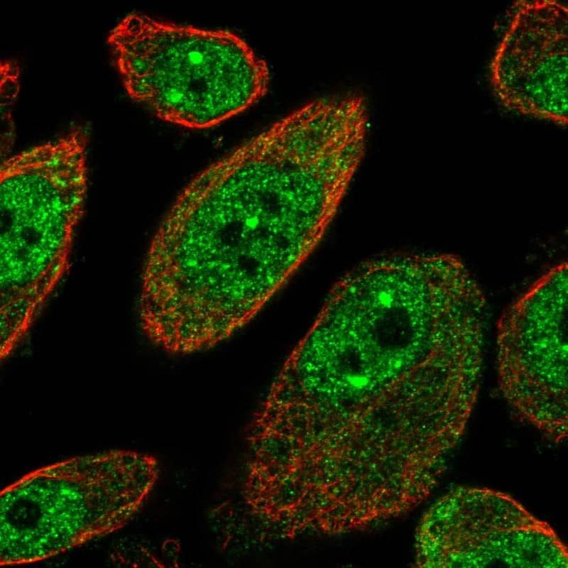 Staining of human cell line PC-3 shows localization to nucleoplasm & nuclear bodies.