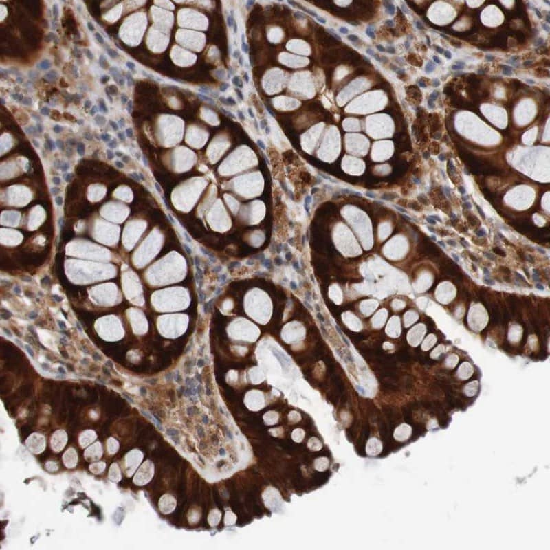 Staining of human colon shows strong cytoplasmic positivity in glandular cells.