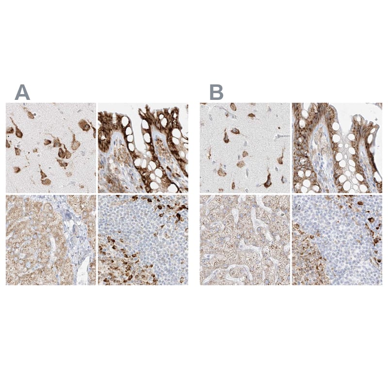 <b>Orthogonal Strategies Validation. </b>Staining of human cerebral cortex, colon, liver and lymph node HPA030829 (A) shows similar protein distribution across tissues to independent antibody HPA030827 (B).