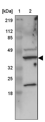 Lane 1: Marker [kDa] 219, 112, 85, 49, 32, 25, 18Lane 2: Human cell line RT-4