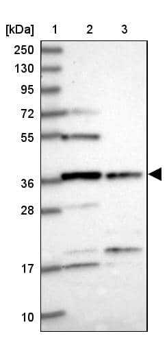 Lane 1: Marker [kDa] 250, 130, 95, 72, 55, 36, 28, 17, 10Lane 2: Human cell line RT-4Lane 3: Human cell line U-251MG sp
