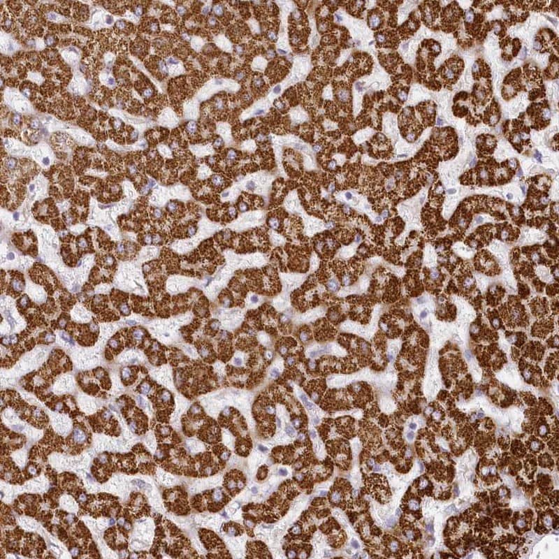 Staining of human liver shows strong cytoplasmic positivity in hepatocytes.