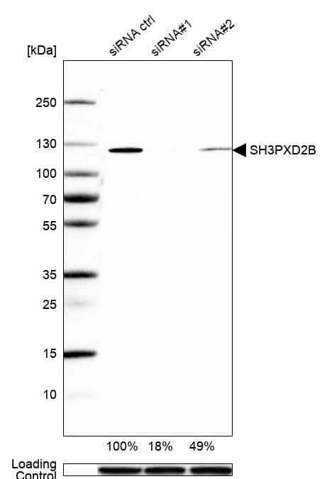 Analysis in U2OS cells transfected with control siRNA, target specific siRNA probe #1 and #2. Remaining relative intensity is presented. Loading control: Anti-GAPDH.