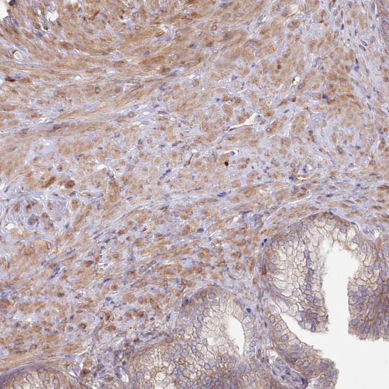 Staining of human prostate shows moderate cytoplasmic positivity in smooth muscle cells.
