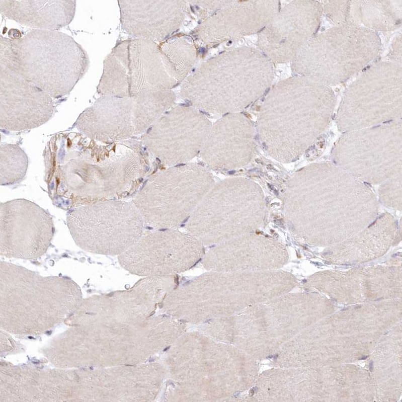 Staining of human skeletal muscle shows low expression in myocytes as expected.