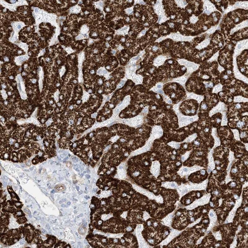 Staining of human liver shows strong cytoplasmic positivity in hepatocytes.