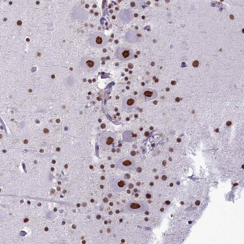 Immunohistochemistry-Paraffin PARPBP Antibody - BSA Free