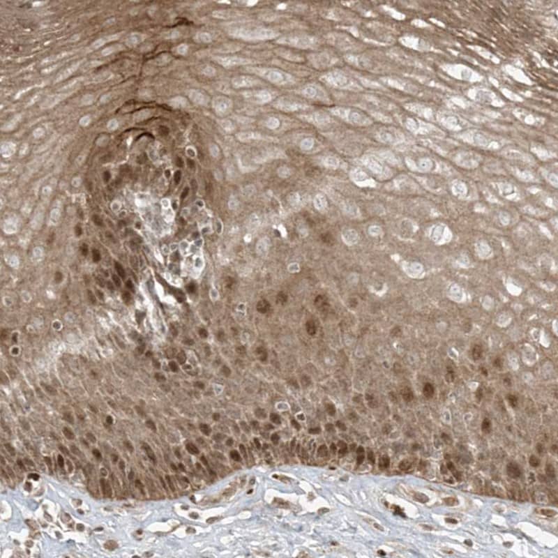 Staining of human esophagus shows moderate cytoplasmic and nuclear positivity in squamous epithelial cells.