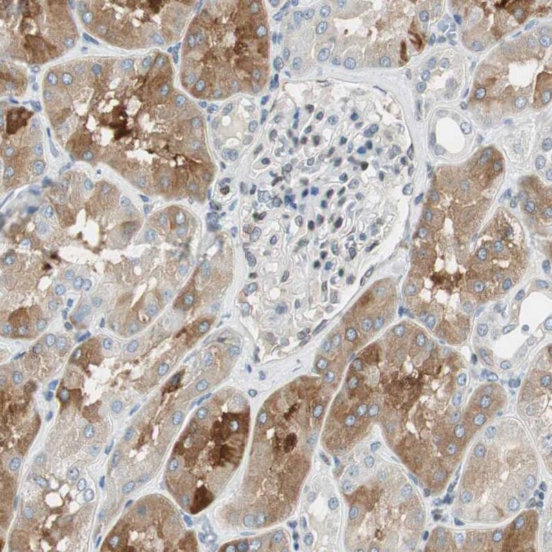 Staining of human kidney shows strong cytoplasmic positivity in cells in tubules.