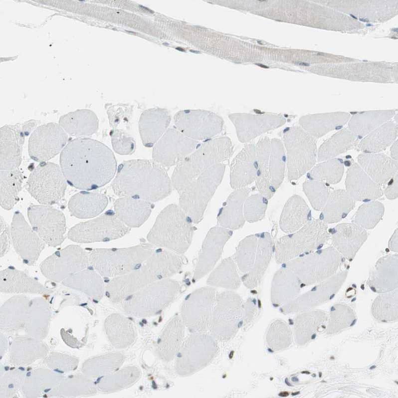 Staining of human skeletal muscle shows no positivity in myocytes as expected.