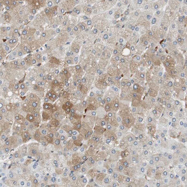Staining of human liver shows strong cytoplasmic positivity in hepatocytes.
