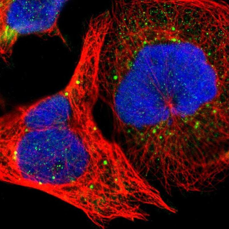 Staining of human cell line A-431 shows localization to cytosol & vesicles.