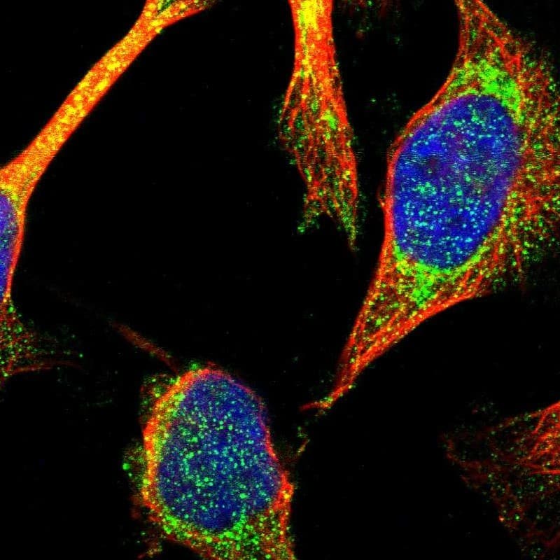 Immunocytochemistry/ Immunofluorescence TTC19 Antibody - BSA Free