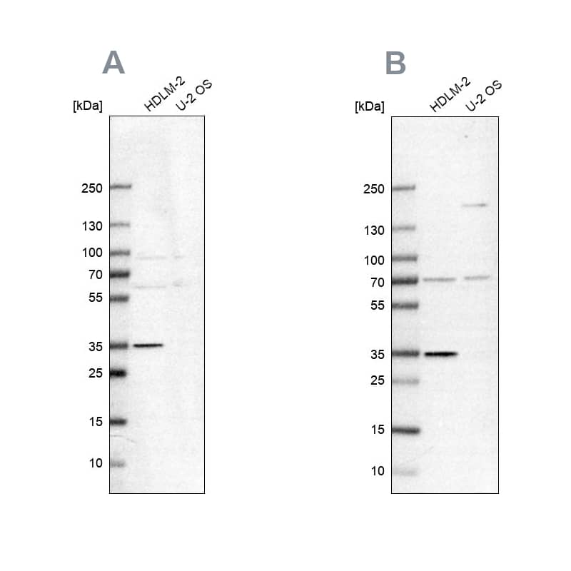 <b>Independent Antibodies Validation. </b>Analysis using antibody NBP1-93979 (A) shows similar pattern to independent antibody NBP2-38667 (B).