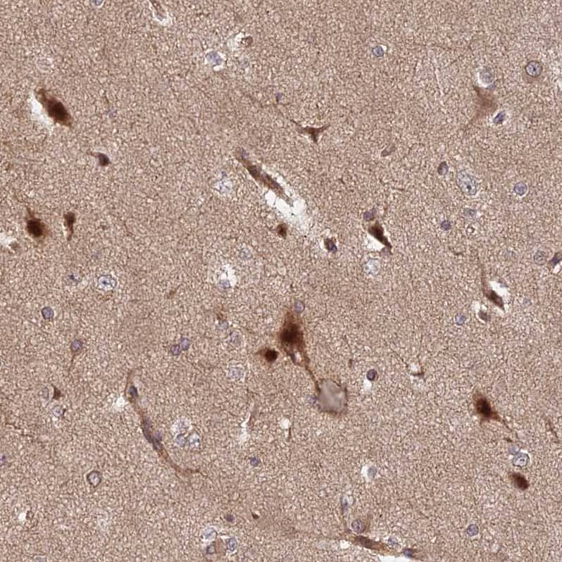 Staining of human cerebral cortex shows strong nuclear positivity in neurons.
